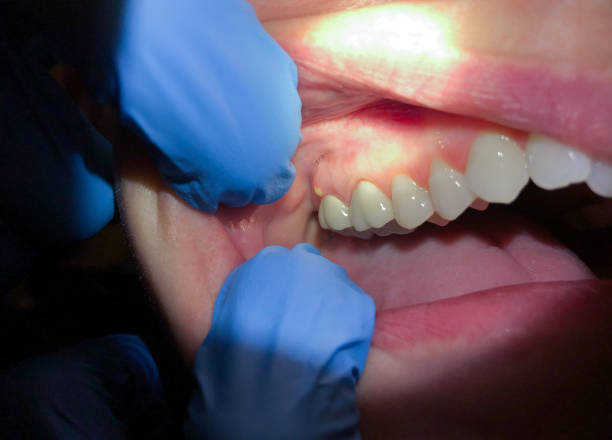 Best Same-Day Emergency Dentist in Odenville, AL