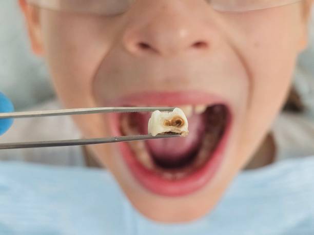 Best Emergency Broken Tooth Repair in Odenville, AL
